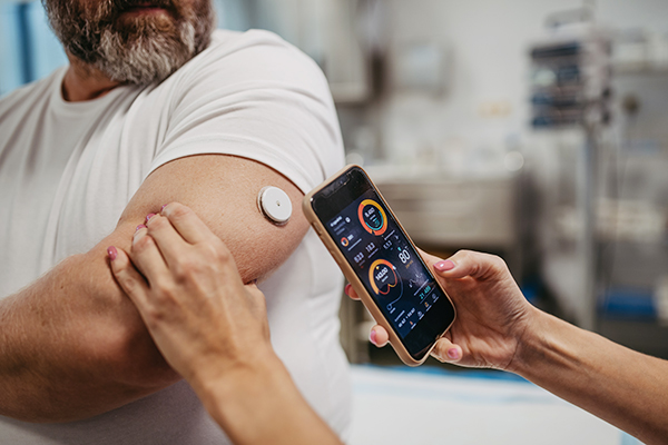 Die Diabetes-Dauermessung am Arm nutzt einen Sensor, der unter die Haut gesteckt wird und die Glukosewerte in der Gewebeflüssigkeit kontinuierlich misst